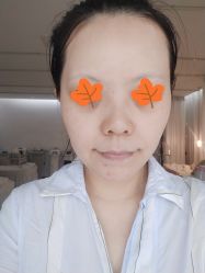 体验后-Let's beauty莱恩轻奢皮肤管理