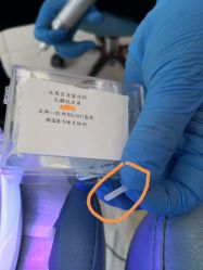 -派恩宜灰指甲鸡眼嵌甲手足癣