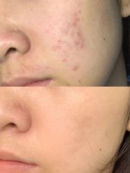 -Cream88颜皮肤管理中心