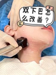 -成都艾特他整形外科医院