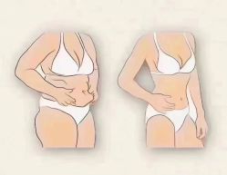 -香薇妮丝女子减肥院