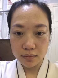-天津健丽·去眼袋医疗美容机构