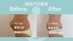 -橘西产后康复中心