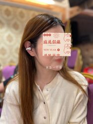 体验后-洁铭新加坡医美