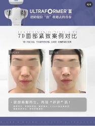 -中科妍美专业脱毛美肤连锁机构
