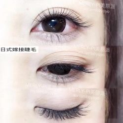 -MLP美丽派·问题肌疗愈中心
