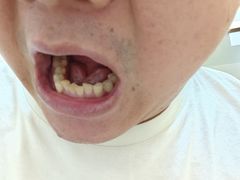 -佛山中大口腔医院·市二级口腔专科医院