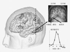 -多特儿童专注力·感统训练·注意力提升培训(锦峰训练中心)