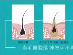 点击看大图 -张昊造型