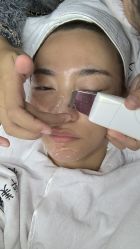 体验前-柠润·Onda塑形·海菲秀·科技美肤中心