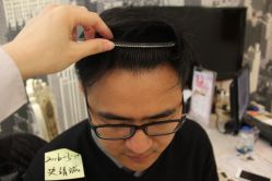 点击看大图 -大麦微针植发丨全国连锁