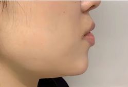 -上海伊莱美医疗美容医院