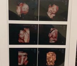 -杭州贝瑞斯美华妇儿医院·早孕·产检·儿科