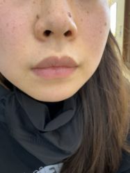 -长沙雅美医疗美容医院
