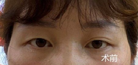 -美莱医学美容医院