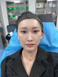 体验前-美莱医学美容医院