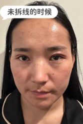 -素美医疗美容·西南眼鼻整形·修复基地