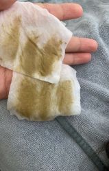 点击看大图 -skin79皮肤管理中心