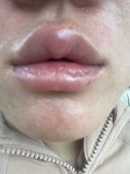 -厦门美莱整形美容医院