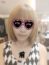 点击看大图 体验前-禾美嘉医疗美容