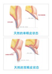-丰联丽格医疗美容·联合丽格眼整形中心