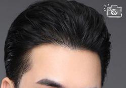 -大麦微针植发丨全国连锁