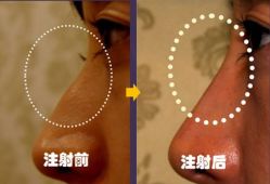 -CMS西美斯·美式医疗美容