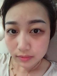 点击看大图 -郡艺医疗美容·微整·眼鼻吸脂
