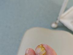 -新甲连锁灰指甲·甲沟炎·鸡眼(黑龙江路店)