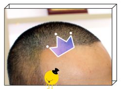 -大麦微针植发全国连锁