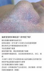 -+MS卓美丝专业祛痘·皮肤管理中心