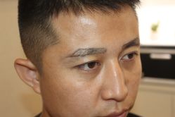 -大麦微针植发丨全国连锁