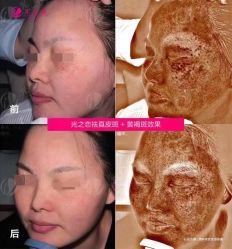 -星港国际·Skin皮肤专研·皮肤管理