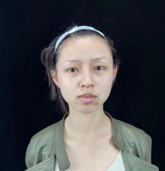 体验前-Yestar艺星医疗美容医院