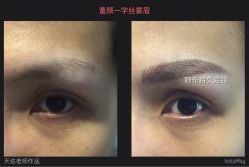 点击看大图 纹绣-光SPA科技美肤