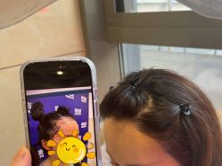 -碧莲盛·不剃发植发