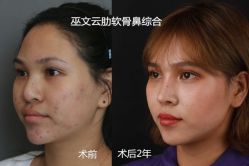 -北京米扬丽格医疗美容·联合丽格鼻整形中心