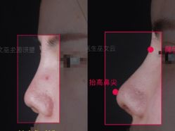 -北京米扬丽格医疗美容·联合丽格鼻整形中心