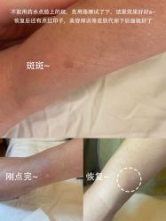 -清疣美疣·痣·斑净肤中心