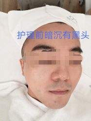 -倩极·精研痘敏肌管理