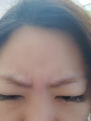 体验前-北京楚诺医疗美容
