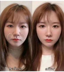 -Yestar 嘉兴艺星医疗美容医院
