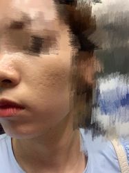 体验前-颜悦医疗美容