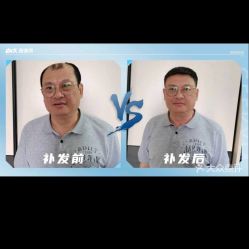 -极客侠男士假发定制补发