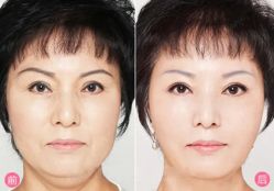 -北京米扬丽格医疗美容·联合丽格鼻整形中心