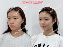 -Yestar重庆艺星医疗美容医院