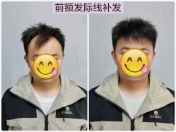 -唐风采假发补发定制