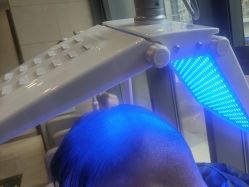 -碧莲盛·不剃发植发