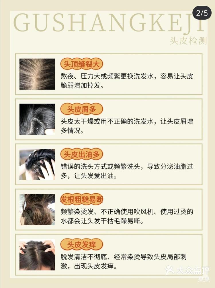 常见5种头皮问题集合!教你如何保养头皮 -大众点评