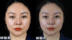 -Yestar重庆艺星医疗美容医院